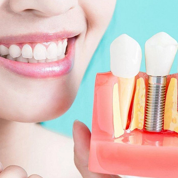 Dentists provide high-quality dental implants for restoring missing teeth and achieving perfect smile.