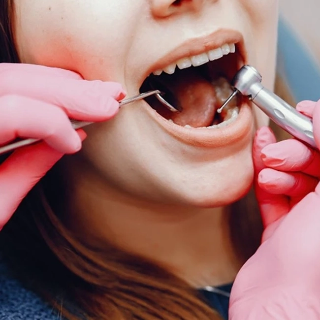 Expert dentists provide safe and effective root canal treatment for healthy teeth in Alwarpet Alwarpet